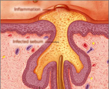 �ɂ��с@�j�L�r�P�A�@�A�N�l